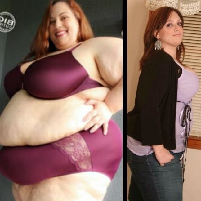 Weight Gain Before And After