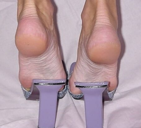 FEET _ sandali e zoccoli