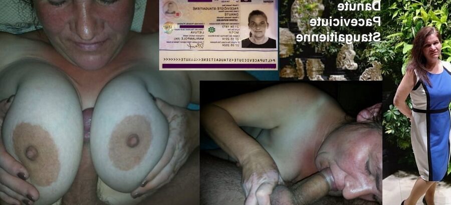 Collected and exposed DP
