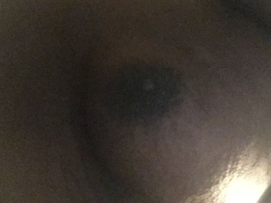 Man boobs