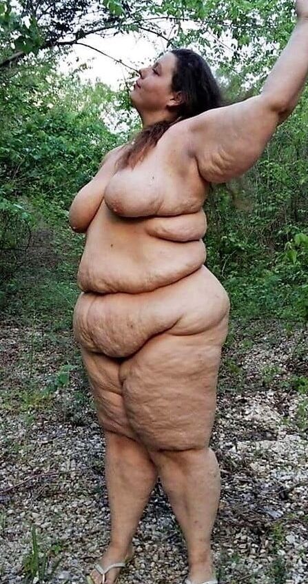 Sexy Cellulite and Stretchmarks