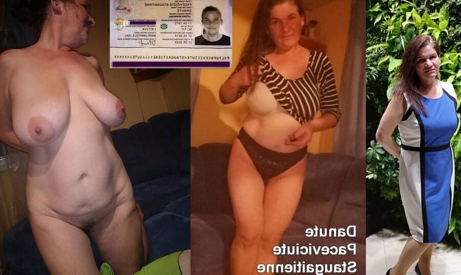 Collected and exposed DP