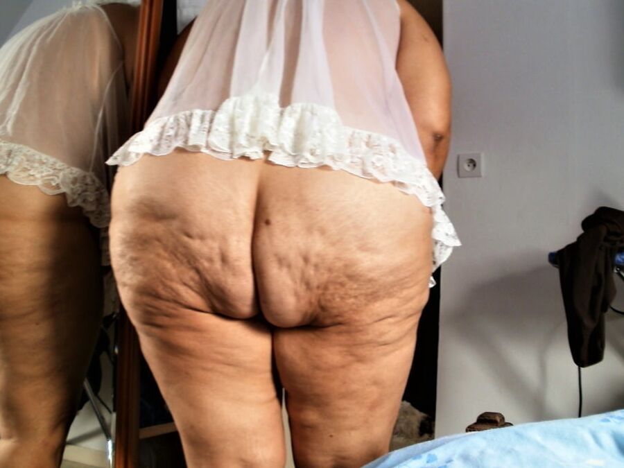 Sexy Cellulite and Stretchmarks