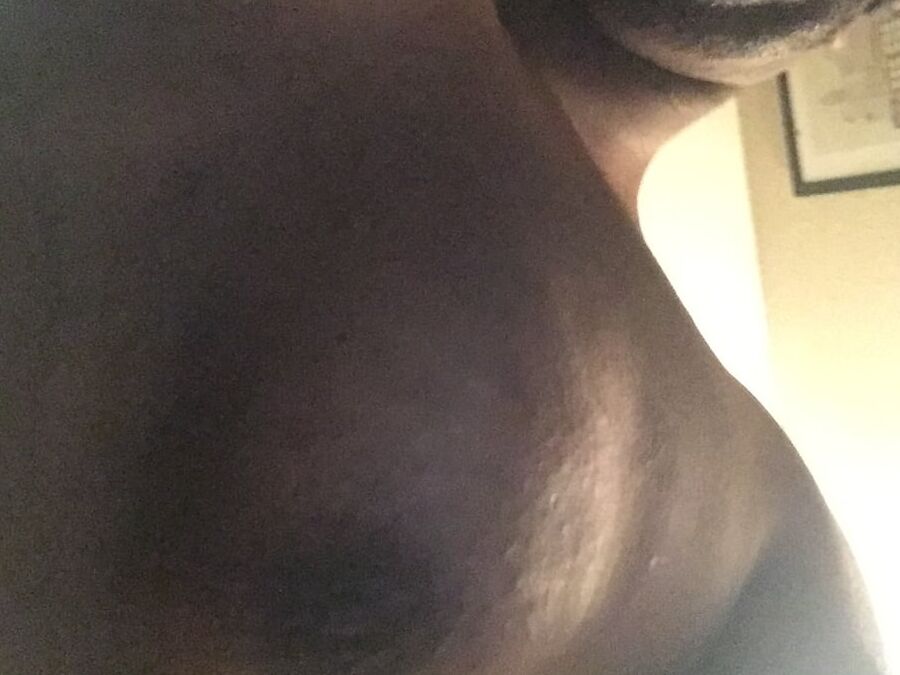 Man boobs