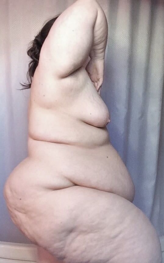 Sexy Cellulite and Stretchmarks