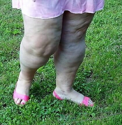 Sexy &amp; Chubby Legs