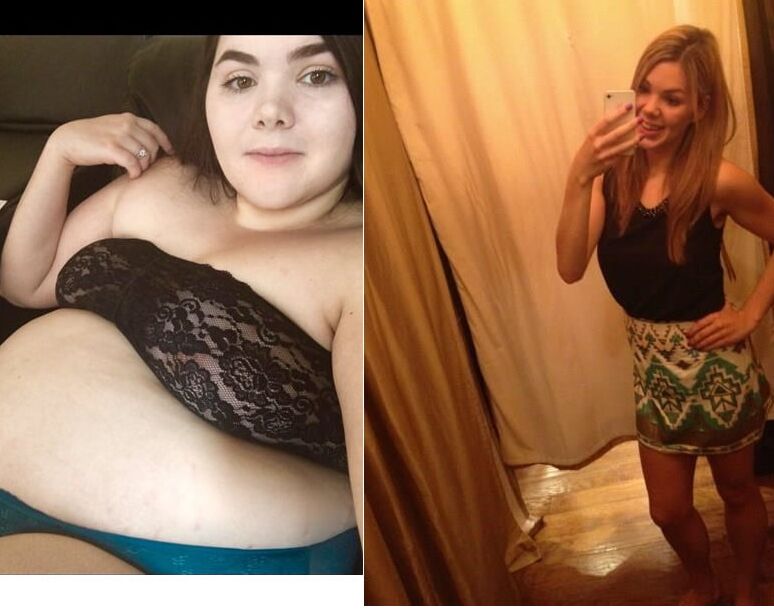 Weight Gain Before And After