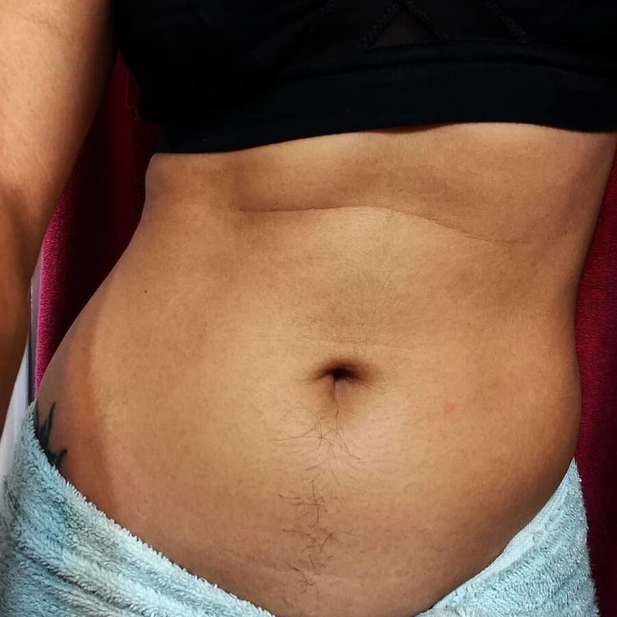 Girls Hairy belly happy trail