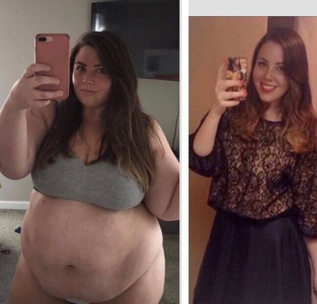 Weight Gain Before And After
