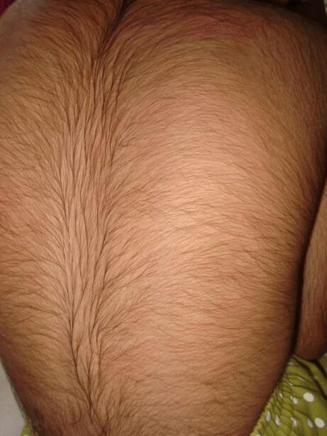 Girls with Back Hair