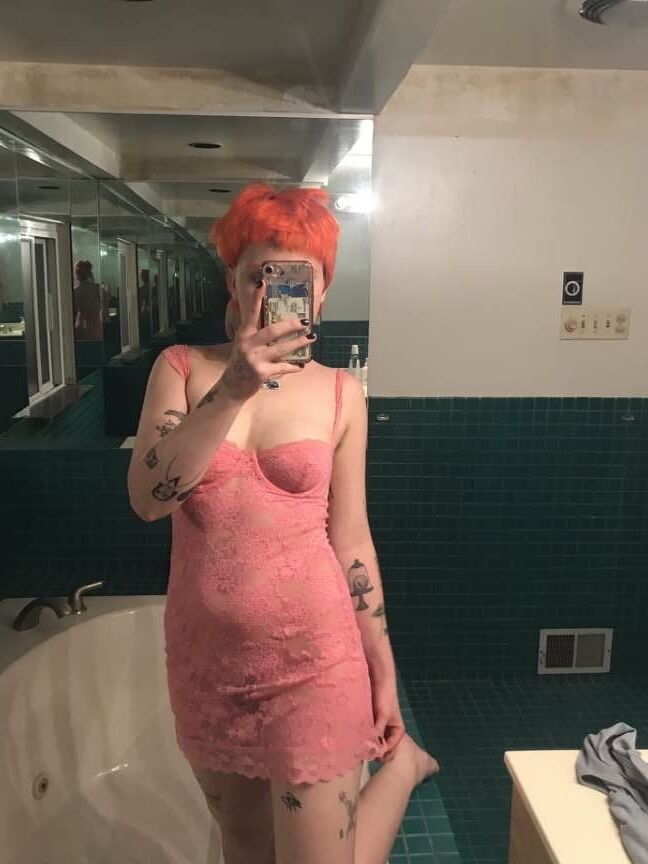 Alexis expose