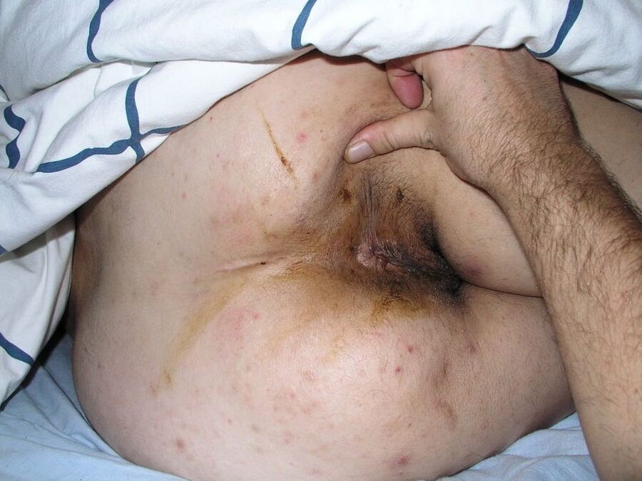 Amateur dirty bum holes