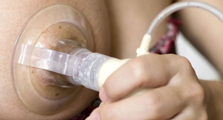 Breast Pumping