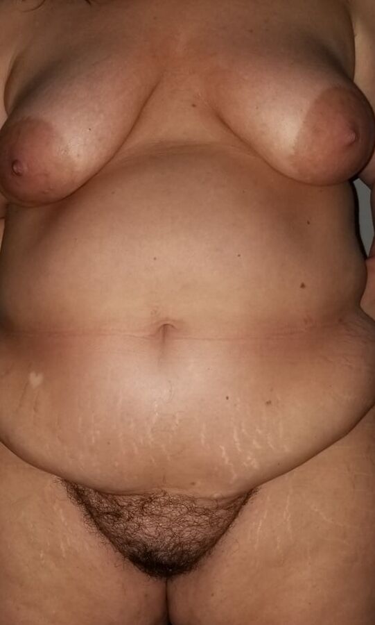 Cellulite