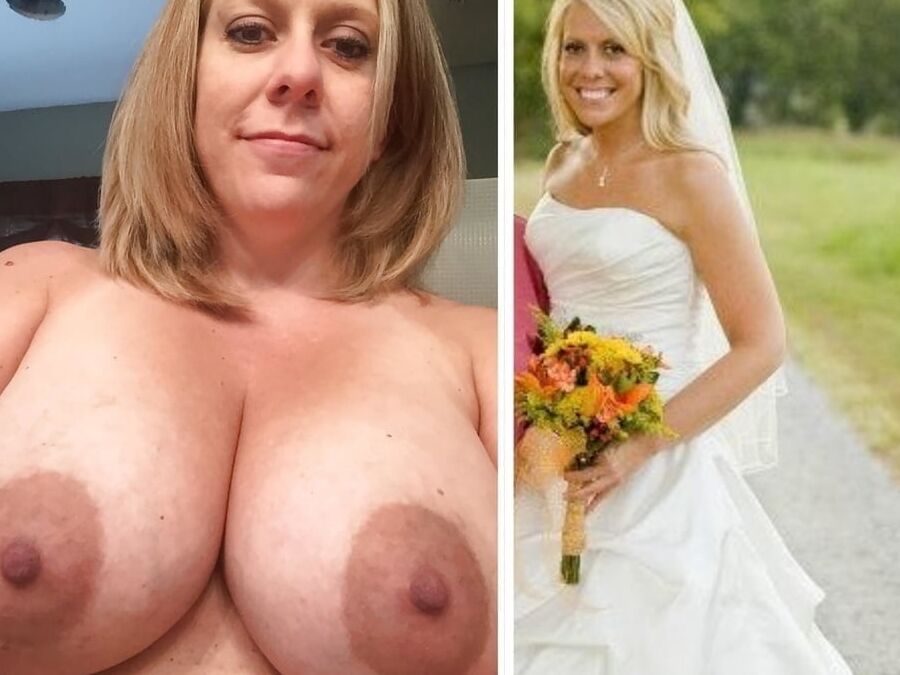 Suckable Areolas