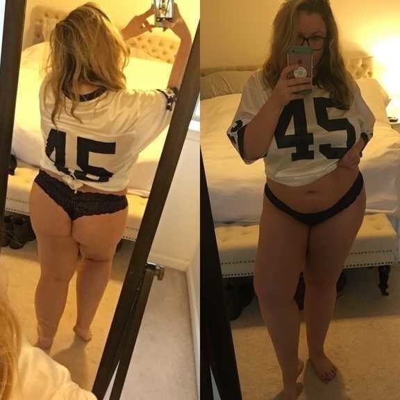 Austyn