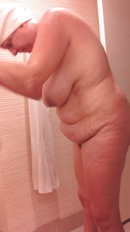 Marks and Bruises