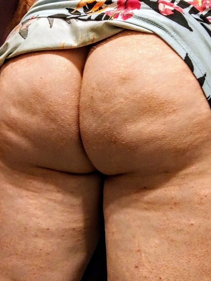 Cellulite