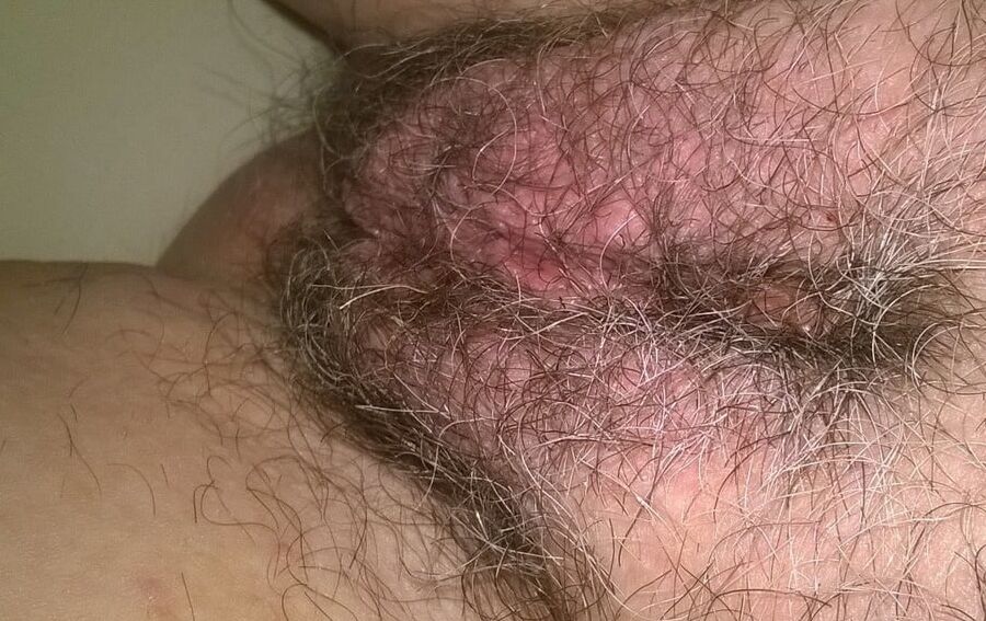 More hair