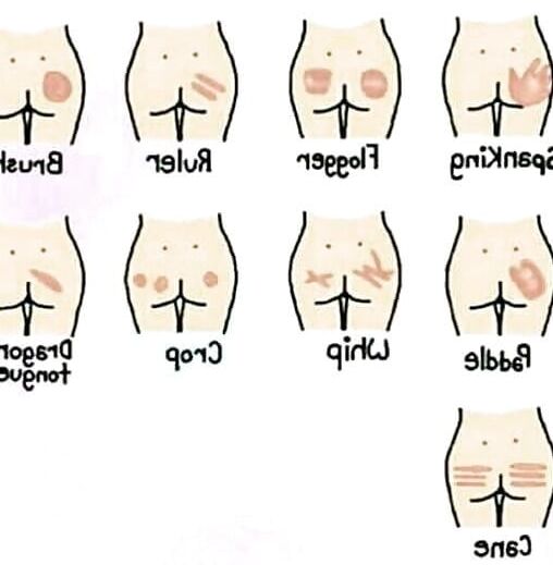 Spanking Signs