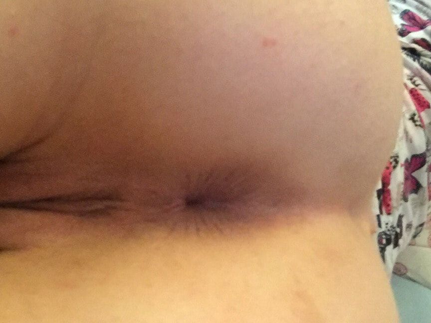 Prolaps vagina