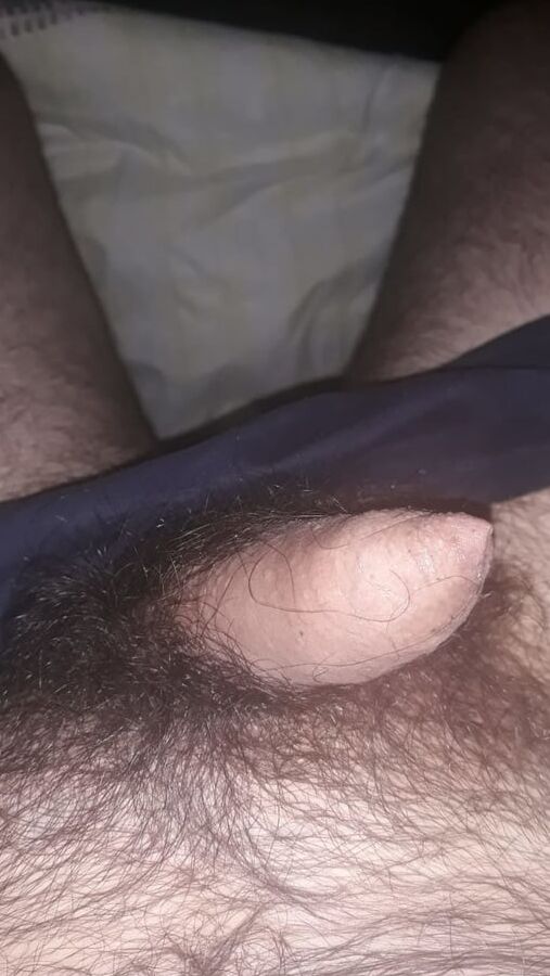 Moja guza