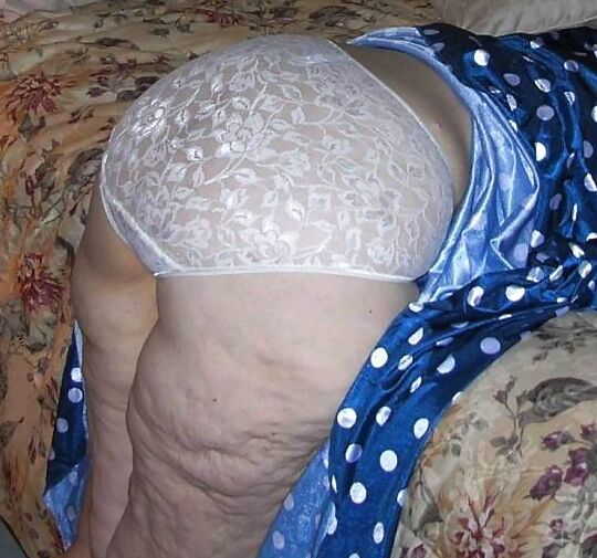 wrinkles