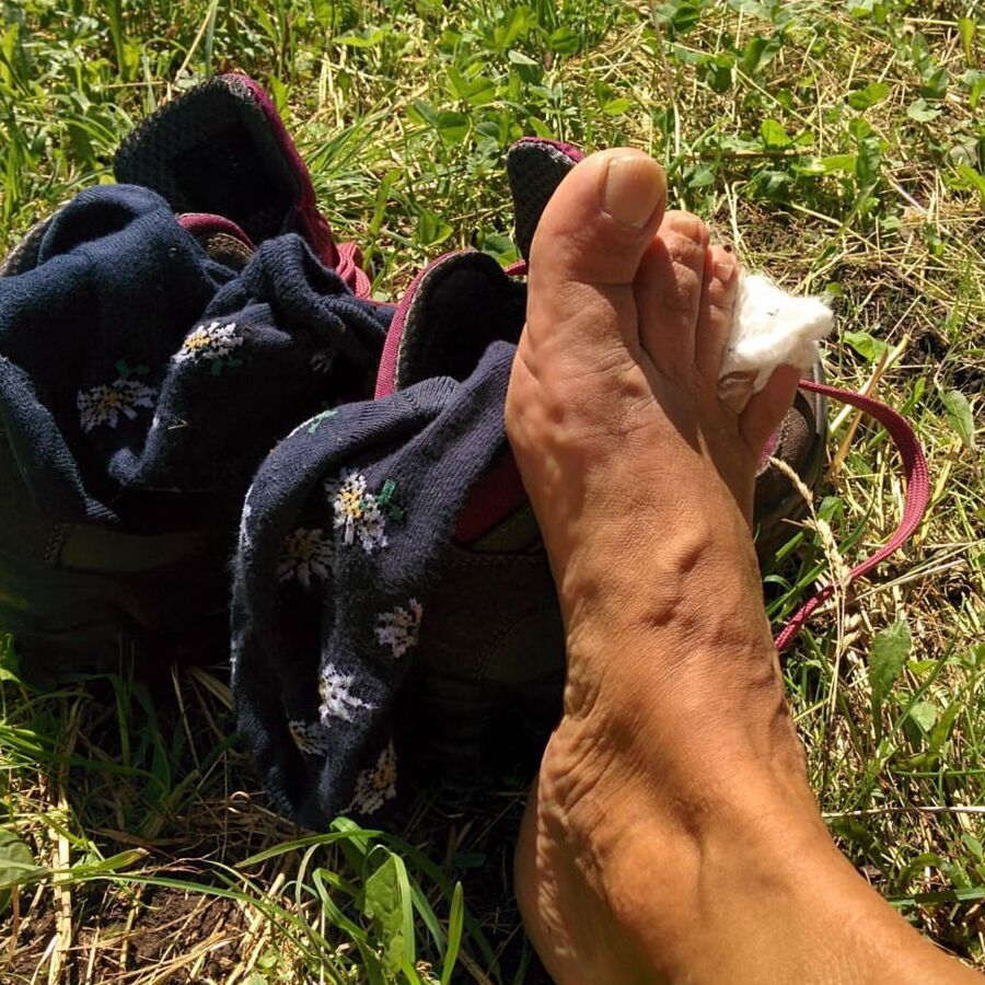 Piante dei piedi mature