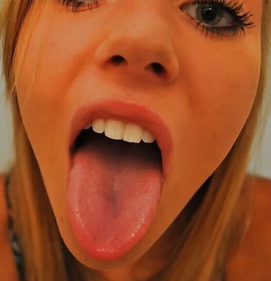 Say HAAAAAaaa!