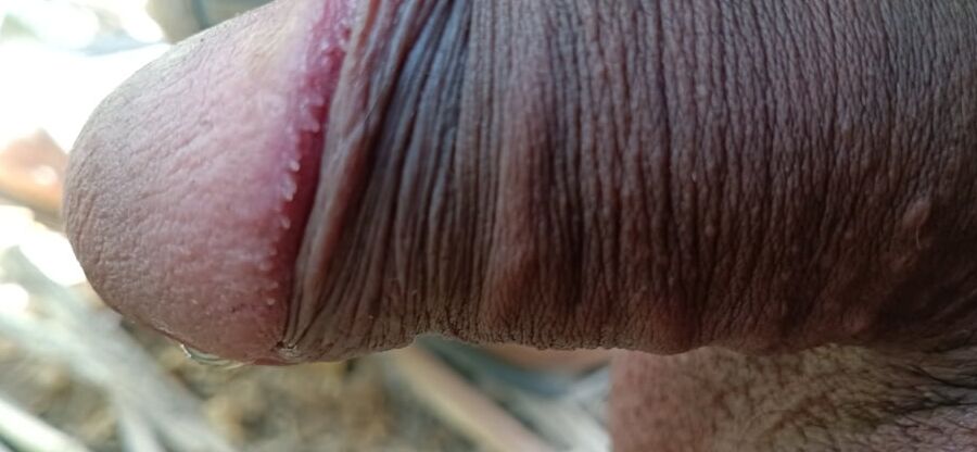Hospital dick flash