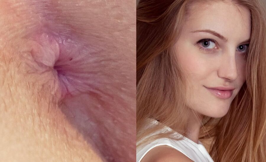 Face and Anus I