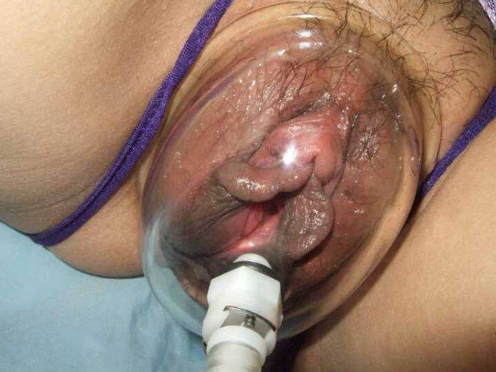 Pussy pump