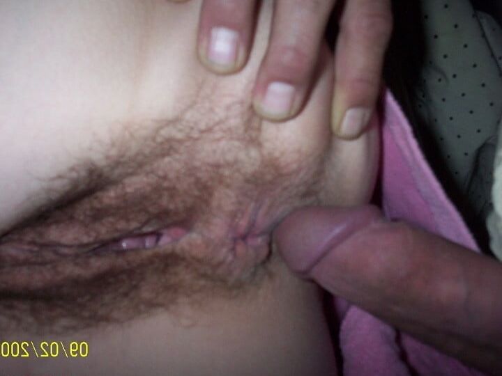 Anal misc