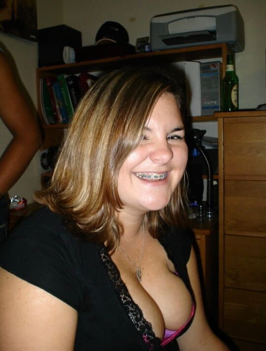 Sexy women wearing braces