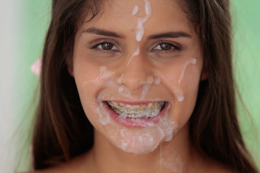 Sexy women wearing braces