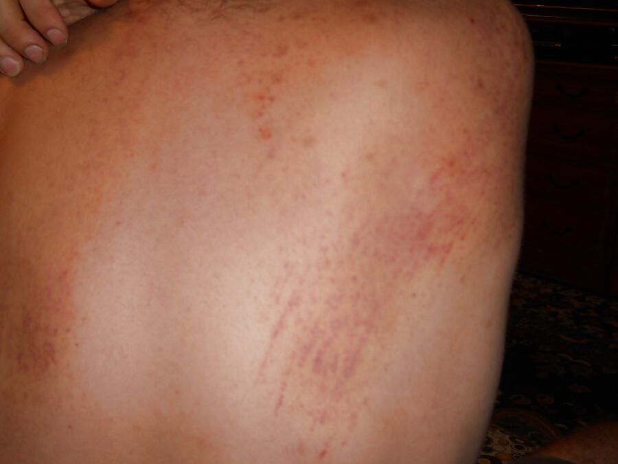 Flogging