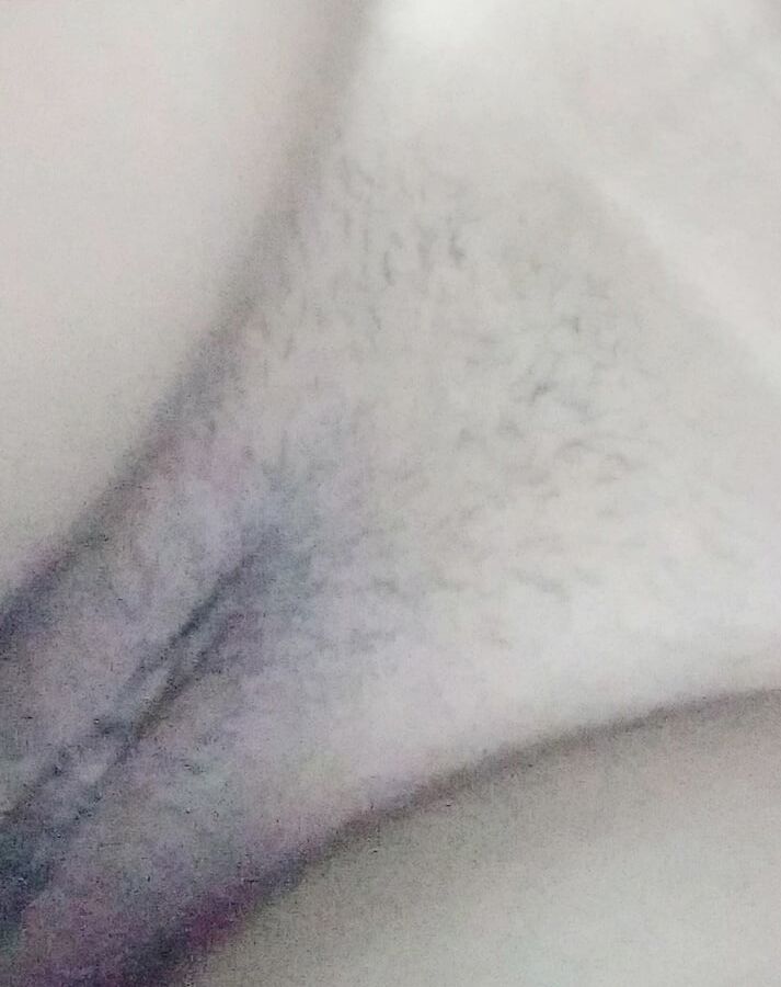.....