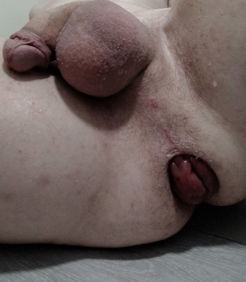 Prolapse