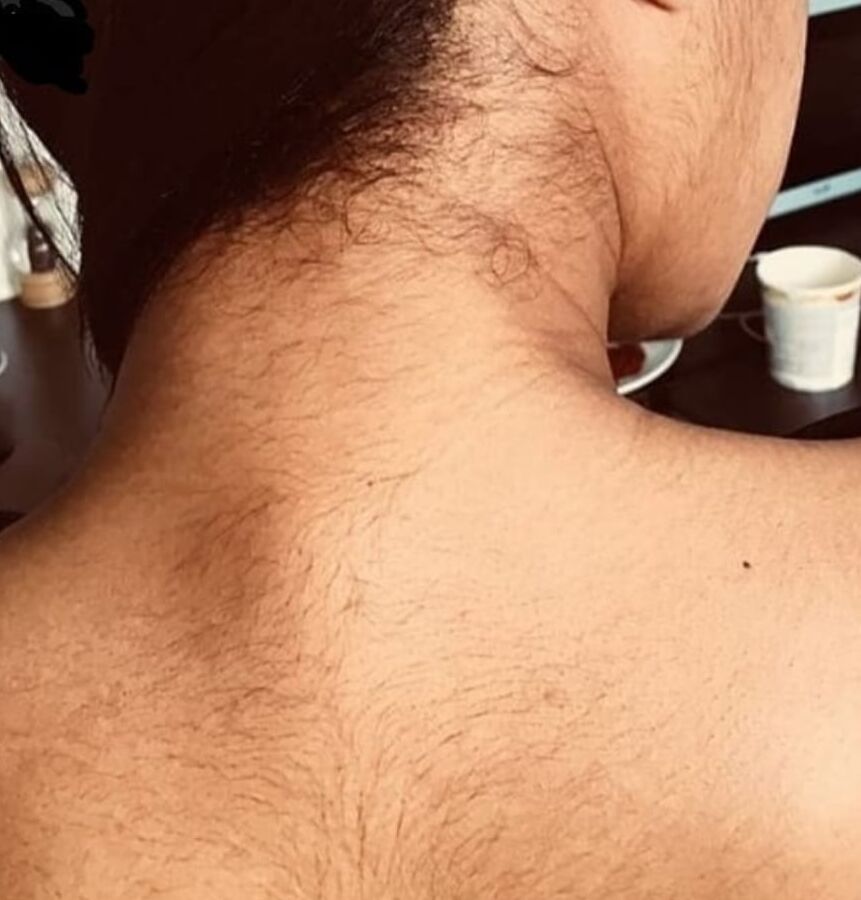 hairy all over