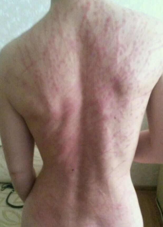 Blonde&;s Back Flogging
