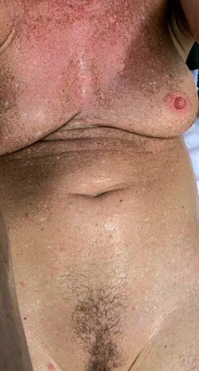 Sunbathing Nude