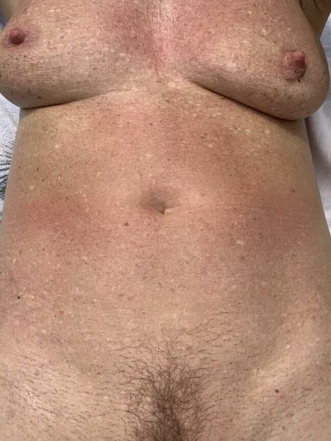 Sunbathing Nude