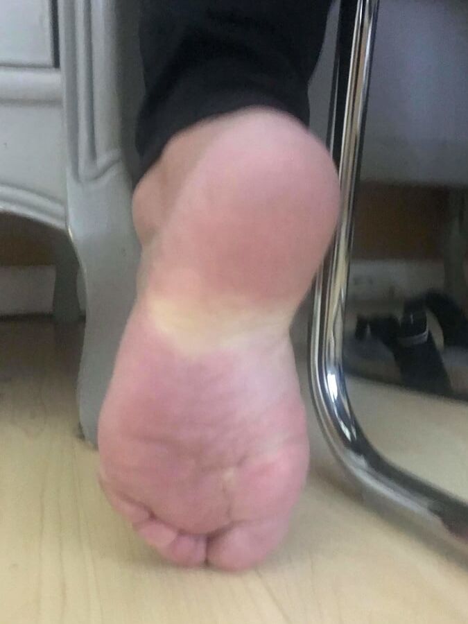 year old BBW mexican Soles Nut draining wrinkles