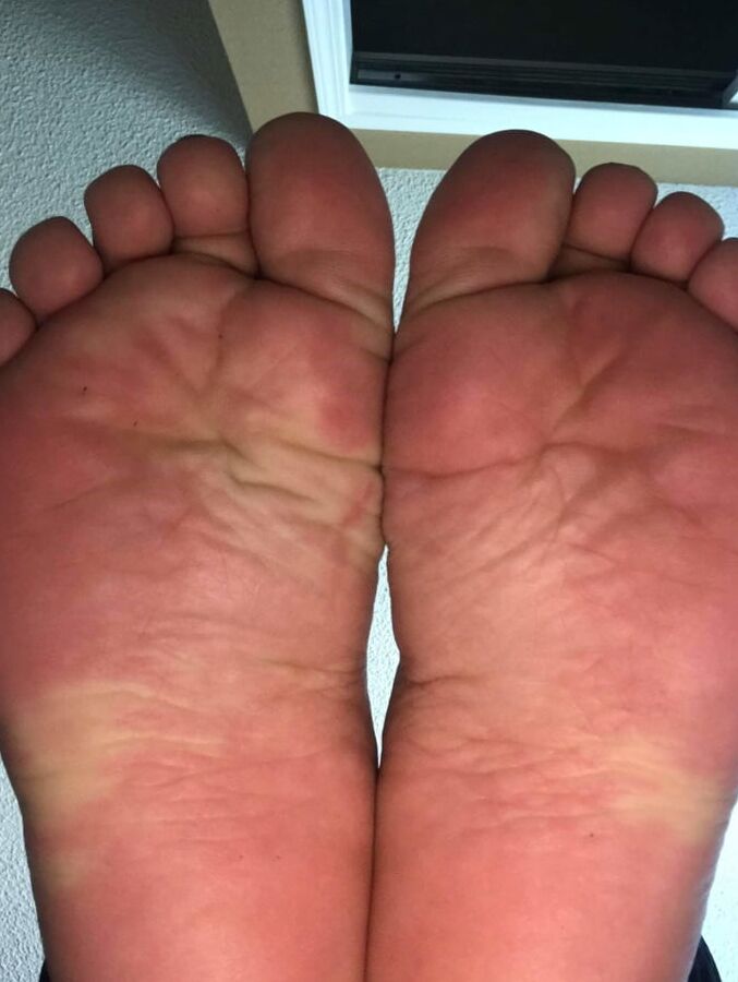 year old BBW mexican Soles Nut draining wrinkles