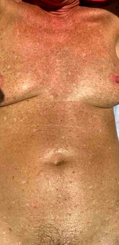 Sunbathing Nude