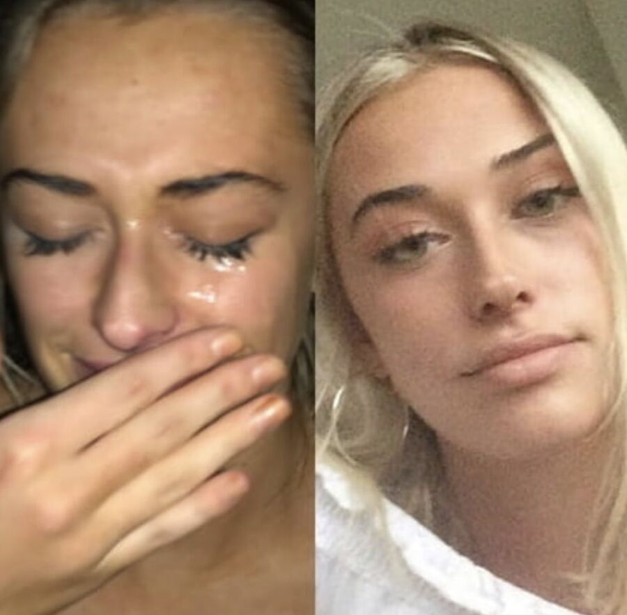 Amateur facials before and after
