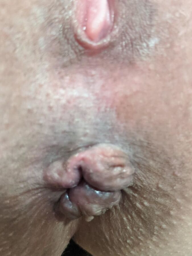 Karla slutwife from mewe