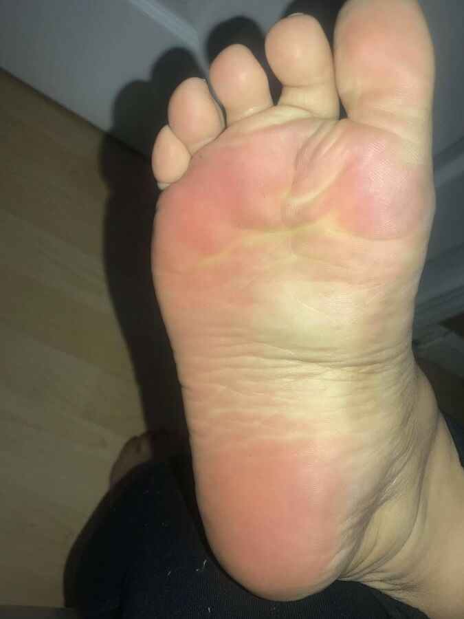 year old BBW mexican Soles Nut draining wrinkles