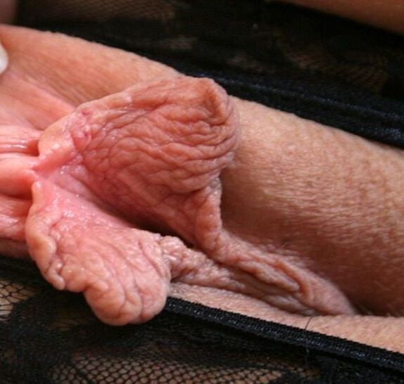 Amateur Photoassarty - Female Pussy