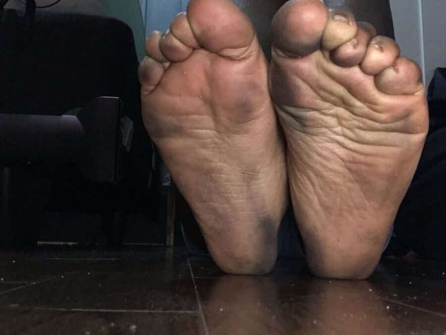 Black Feet